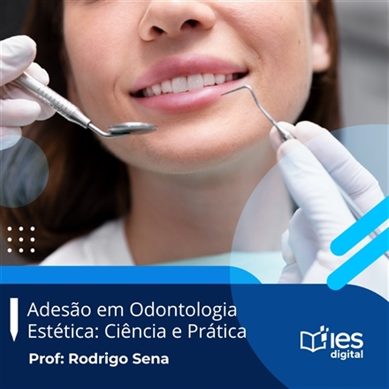 Adesão em Odontologia Estética: Ciência e Prática