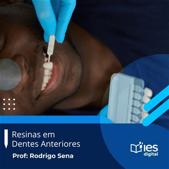 Resinas em Dentes Anteriores