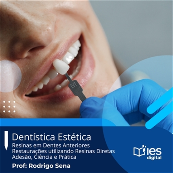 Dentística Estética Completo - Resinas em Dentes Anteriores / Restaurações utilizando Resinas Diretas / Adesão, Ciência e Prática